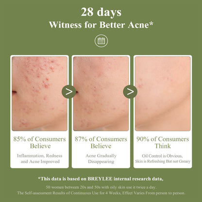 Tea Tree Acne Gel 15g Emergency Type Amazon Cross-border