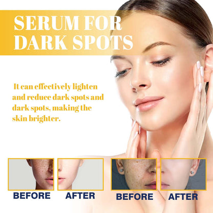 HOYGI for Dark Spots - All-in-One Nightly Serum for Fading Dark Spots & Evening Skin Tone with Retinol, Kojic Acid & Tranexamic Acid